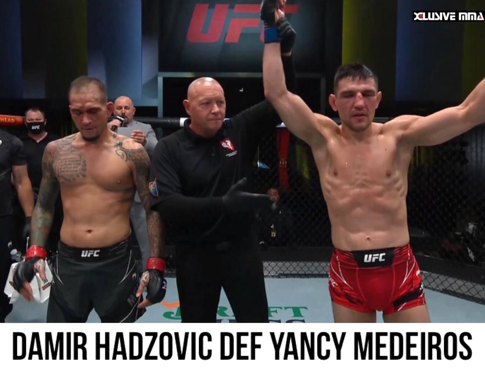 Yancy Medeiros loss to Damir Hadzovic was heartbreaking